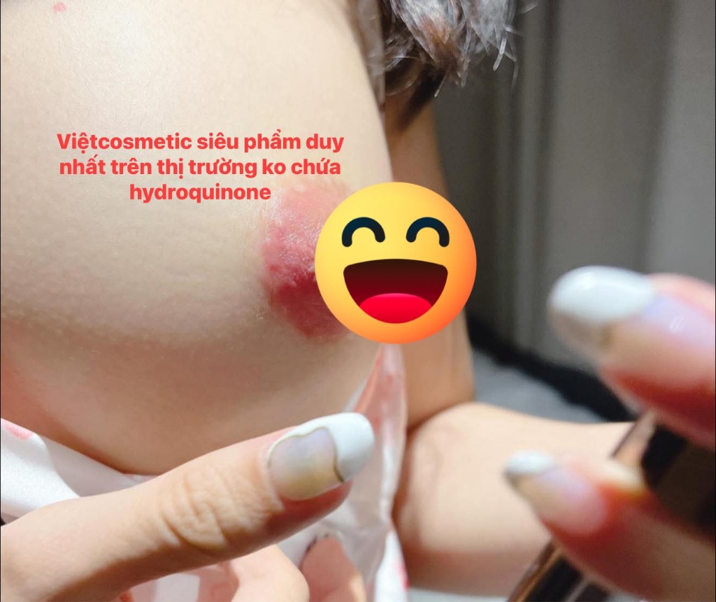 Kết quả sử dụng Vietcosmetic